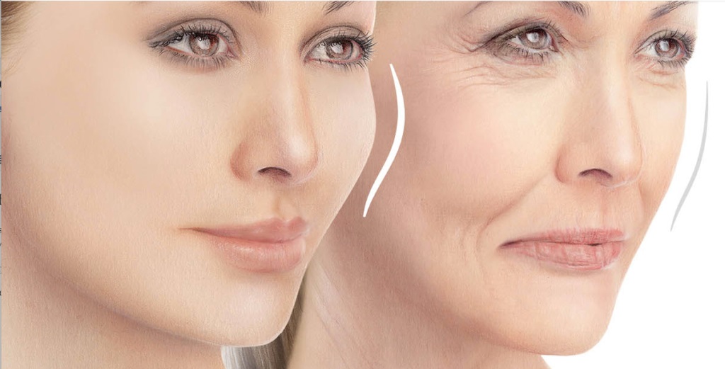 آیا راهی برای رهایی از خط لبخند وجود دارد؟