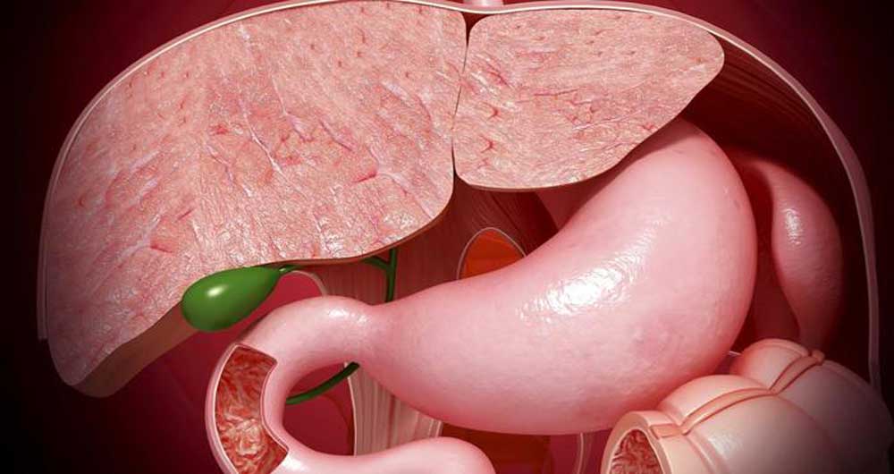 علائم علل تشخیص و درمان کیسه صفرا