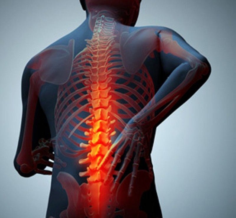 ساییدگی ستون فقرات علائم ، درمان ، جلوگیری و عوارض
