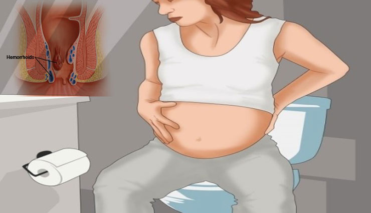 علائم انواع دلایل تشخیص و پیشگیری از بواسیر