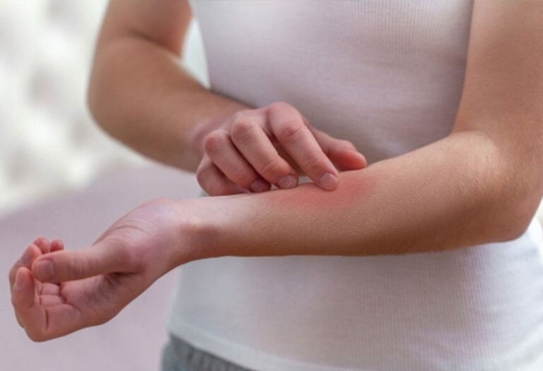 مشکلات پوستی بعد از ابتلا به کرونا