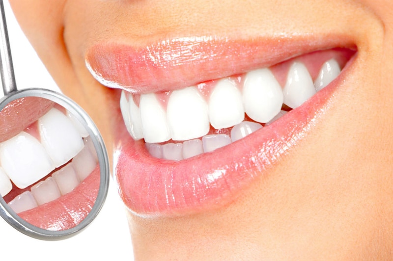 بلیچینگ پرعارضه ترین روش دندانپزشکی