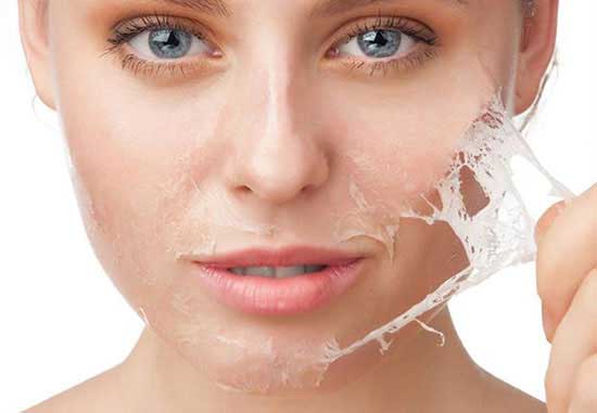 لایه برداری پوست چیست و چگونه است؟