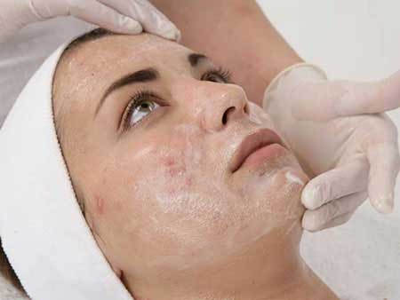 لایه برداری پوست چیست و چگونه است؟