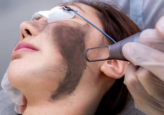 لایه برداری پوست چیست و چگونه است؟