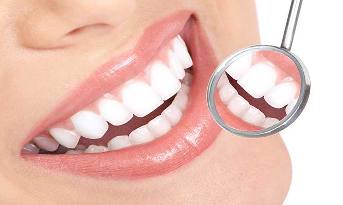 لمینت دندان چیست؟ انواع لمینت دندان ، مزایا و معایب آن لمینت دندان چیست؟ انواع لمینت دندان ، مزایا و معایب آن