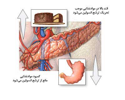 چه کسانی در معرض کتواسیدوز دیابتی قرار می گیرند؟ چه کسانی در معرض کتواسیدوز دیابتی قرار می گیرند؟
