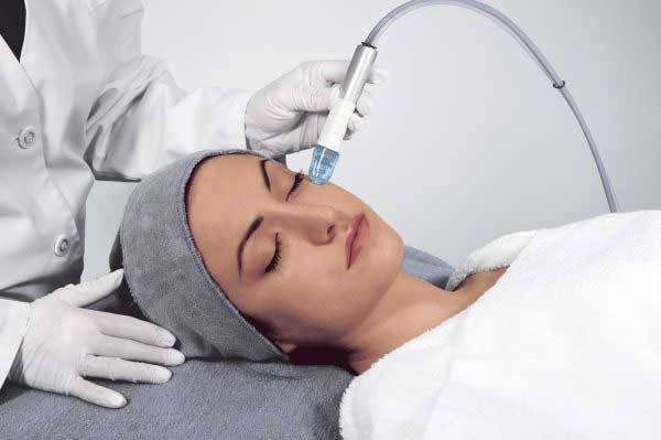  نحوه انجام و فواید میکرودرم ابریژن در خانه