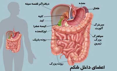 بیماری پریتونیت ؛ علل ، علائم و درمان آن